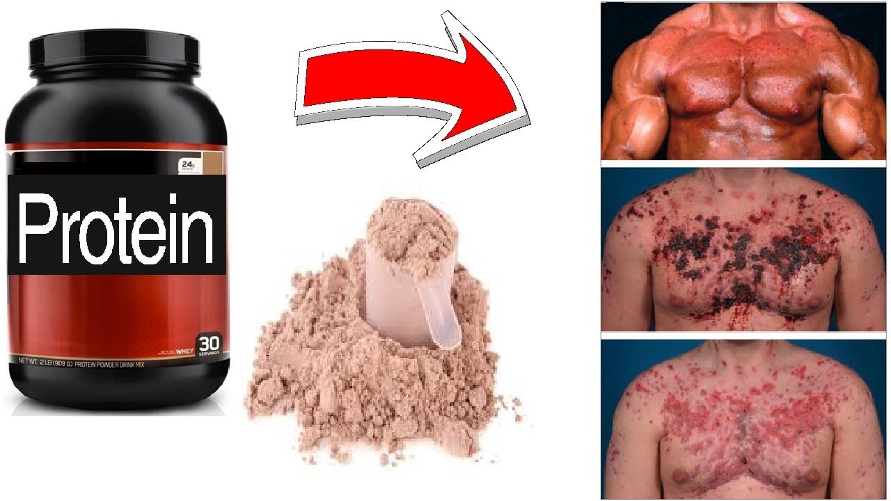 side effect of protein powder.