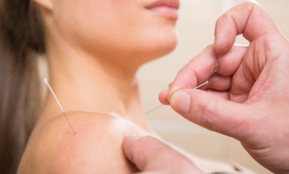 Acupuncture Points For Frozen Shoulder Treatment