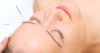 Acupuncture Treatment For Eye Problems