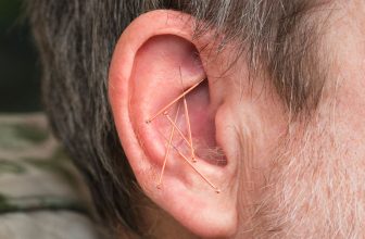 Acupuncture Treatment For Tinnitus