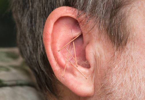 Acupuncture Treatment For Tinnitus