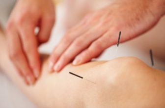 Acupuncture Treatment For Varicose Veins