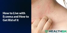 How to Live with Eczema and How to Get Rid of it