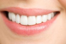 5 Key Benefits of Porcelain Veneers for a Perfect Smile: Expert Guide
