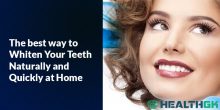 The best way to Whiten Your Teeth Naturally and Quickly at Home
